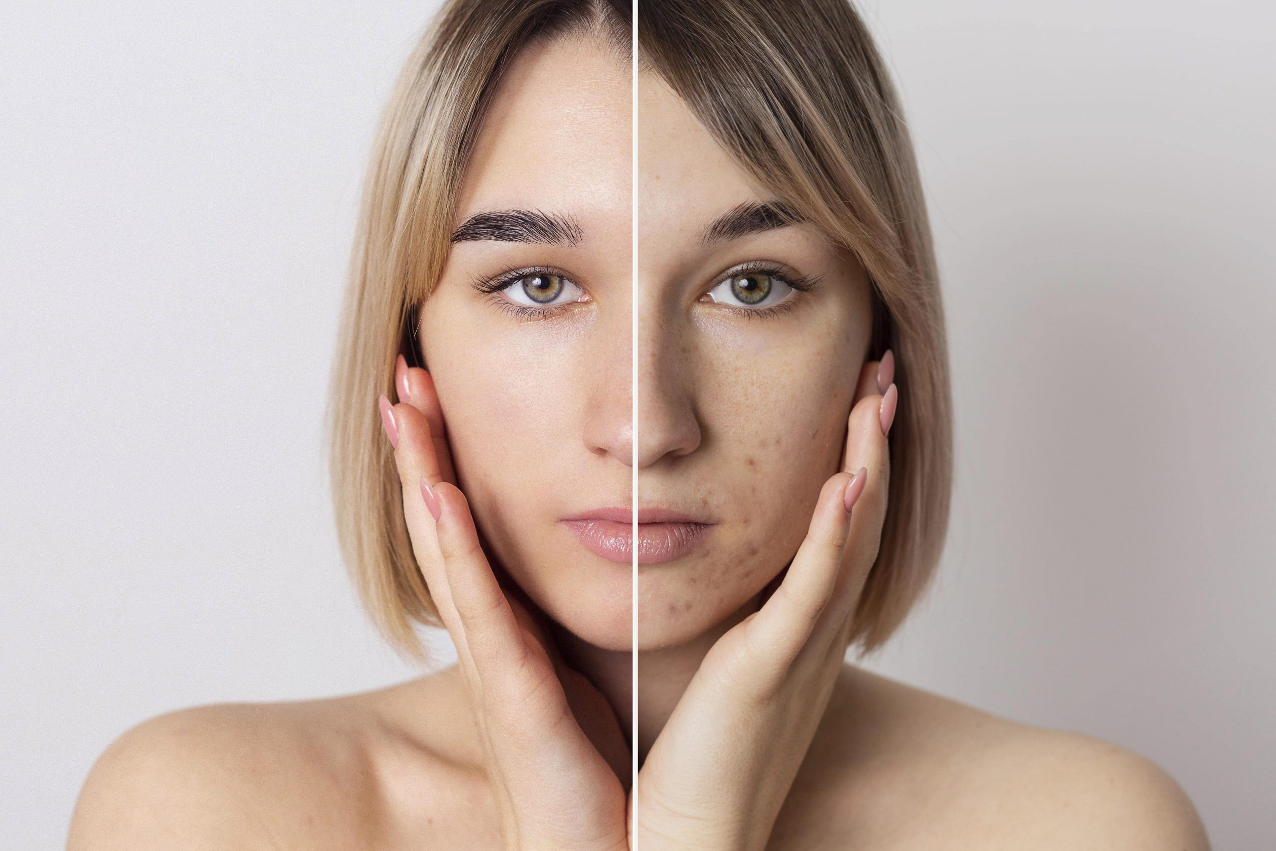 Image de <a href="https://fr.freepik.com/photos-gratuite/avant-apres-portrait-femme-retouche_18962227.htm#query=peeling&position=0&from_view=search&track=sph">Freepik</a>