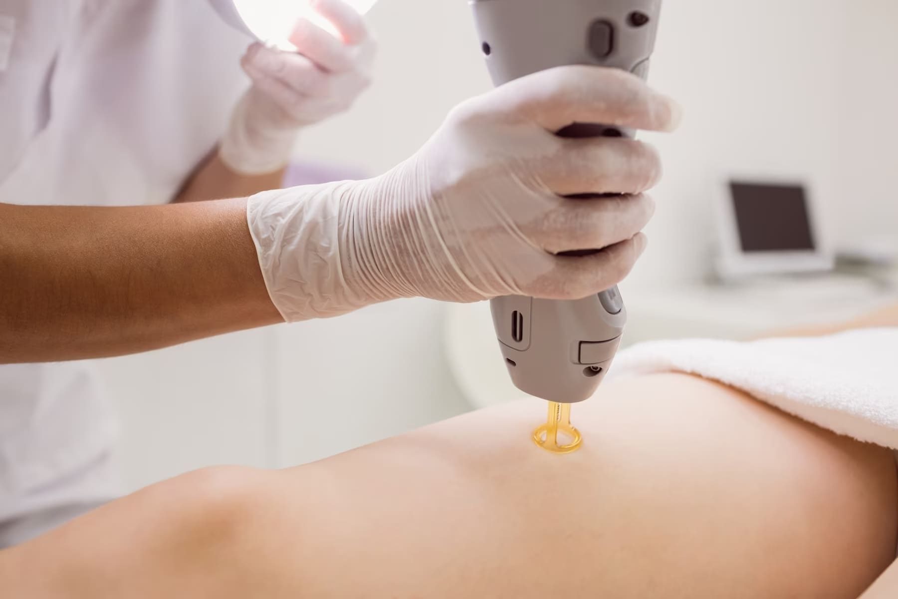 Image de freepik épilation laser 