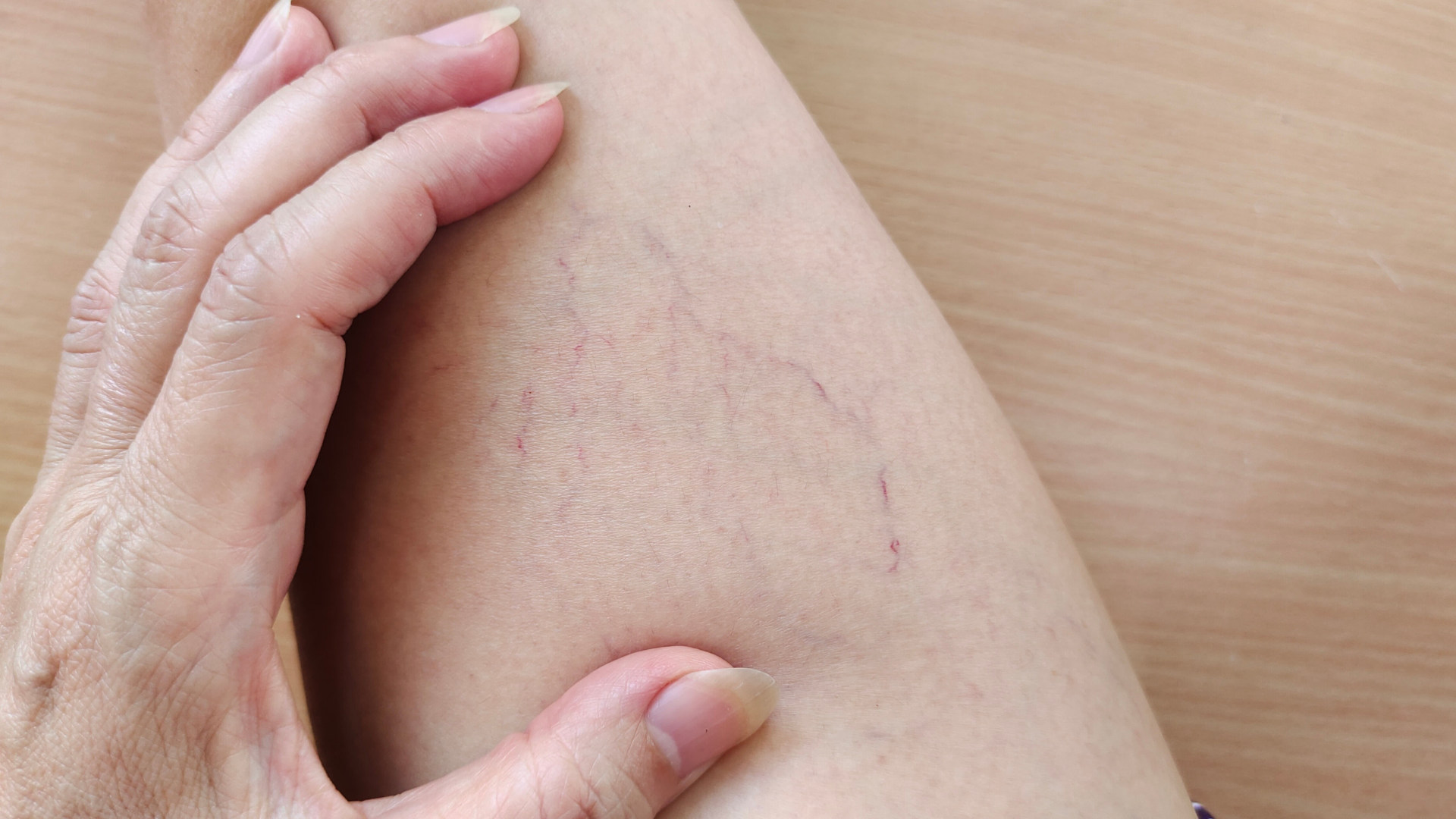 laser vasculaire, image de https://www.canva.com/